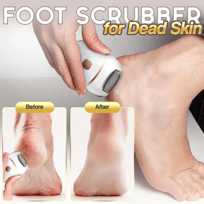🔥Exfoliante de pies eléctrico recargable