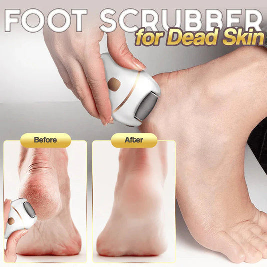 🔥Exfoliante de pies eléctrico recargable