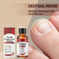 💅🌟 Esencia reparadora para uñas – ¡Fortalece y regenera las uñas dañadas en 7 días! ✨💪 Resultados visibles, dermatológicamente probado. Tu solución para unas uñas fuertes y saludables.
